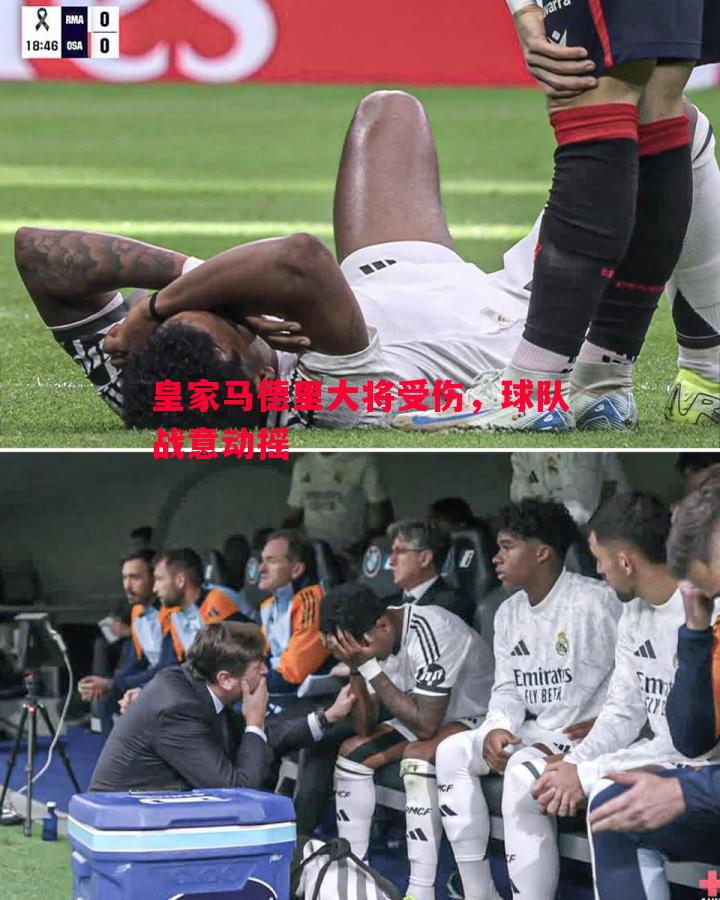 皇家马德里大将受伤,球队战意动摇 皇家马德里大将受伤,球队战意动摇
